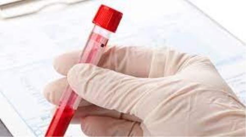 شروع بزرگترین آزمایش جهانی تست خون برای تشخیص ۵۰ نوع سرطان