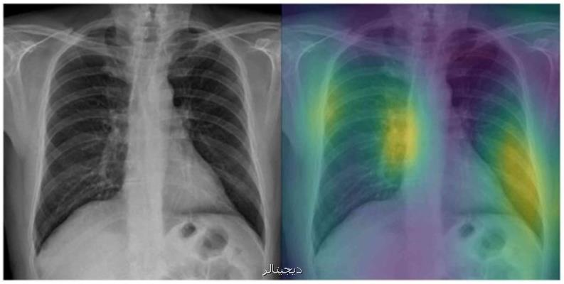 شناسایی سریع كووید-۱۹ با كمك یك مدل مبتنی بر اشعه ایكس و هوش مصنوعی