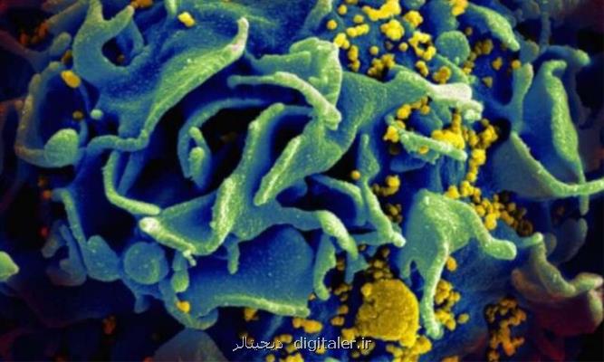 شناسایی یك التهاب جدید در افراد مبتلا به ایدز